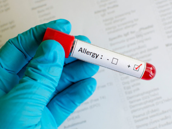 Allergy Blood Test Image