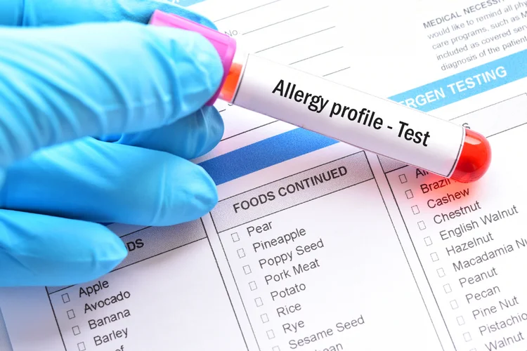 Blood sample labelled Allergy Profile Test placed on a form listing common food allergens in Singapore.