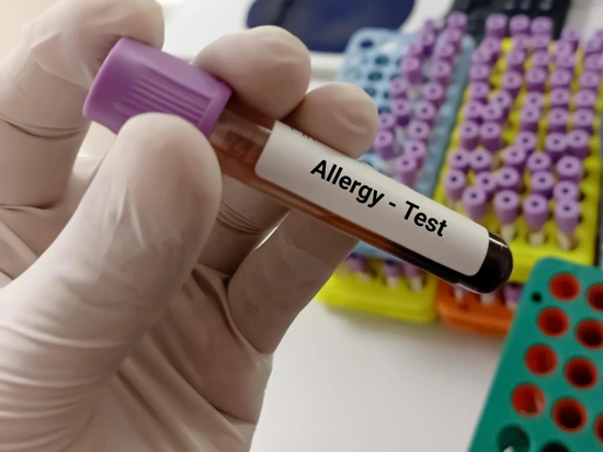 Test tube of patient's blood used for allergy testing.