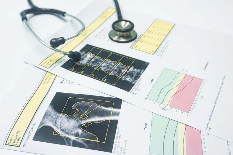 Bone mineral density test results with T-scores and Z-scores for assessing osteoporosis risk and tracking bone health.