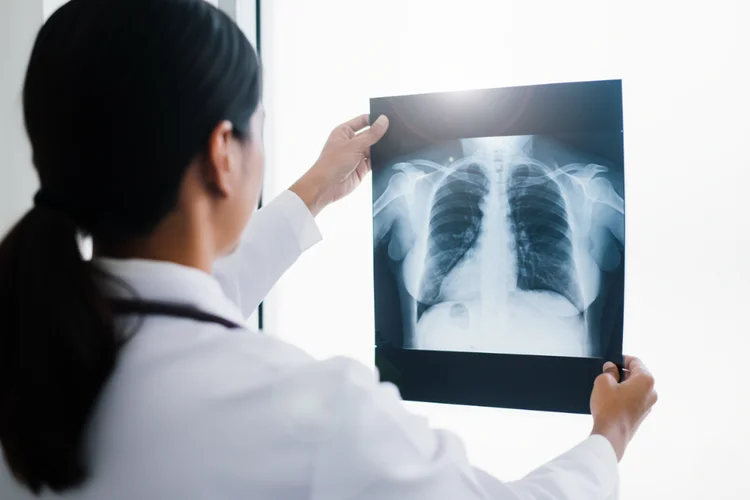 Doctor examining chest X-ray during pre-employment medical screening for tuberculosis detection.