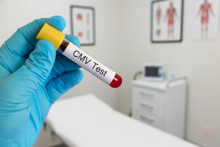 Gloved hand holding blood sample labelled CMV test in medical clinic for cytomegalovirus diagnosis.