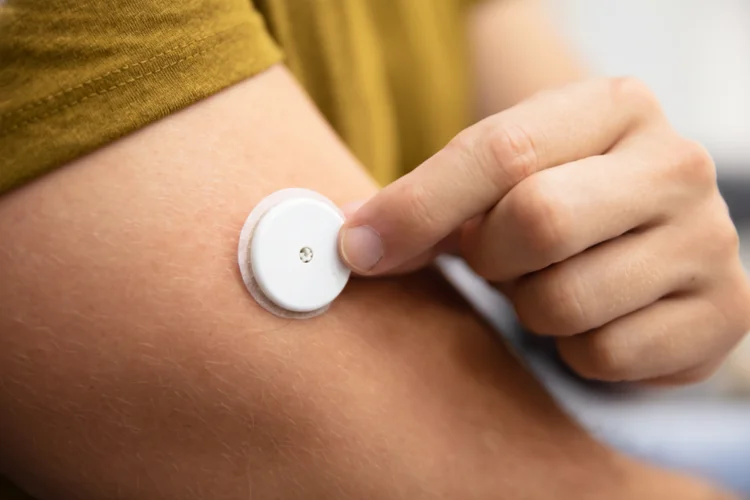 Close-up of glucose sensor applied on upper arm showing how continuous glucose monitoring works.