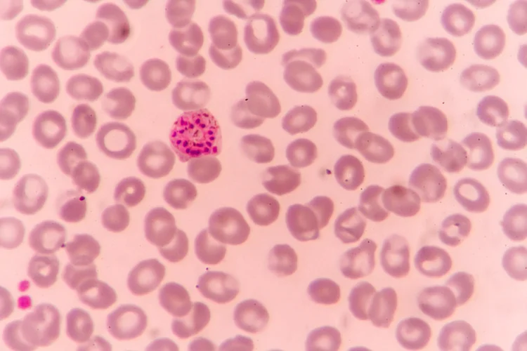 Microscopic view of Plasmodium parasites in red blood cells showing how malaria infection occurs.