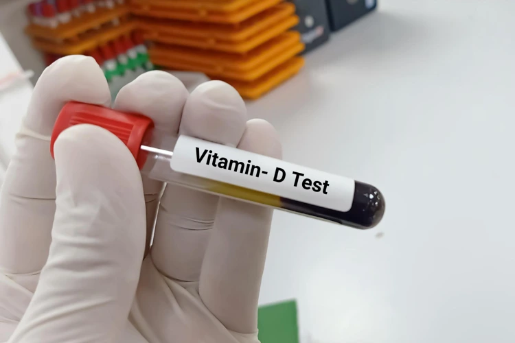 Test tube of patient's blood to be tested for Vitamin D deficiency.